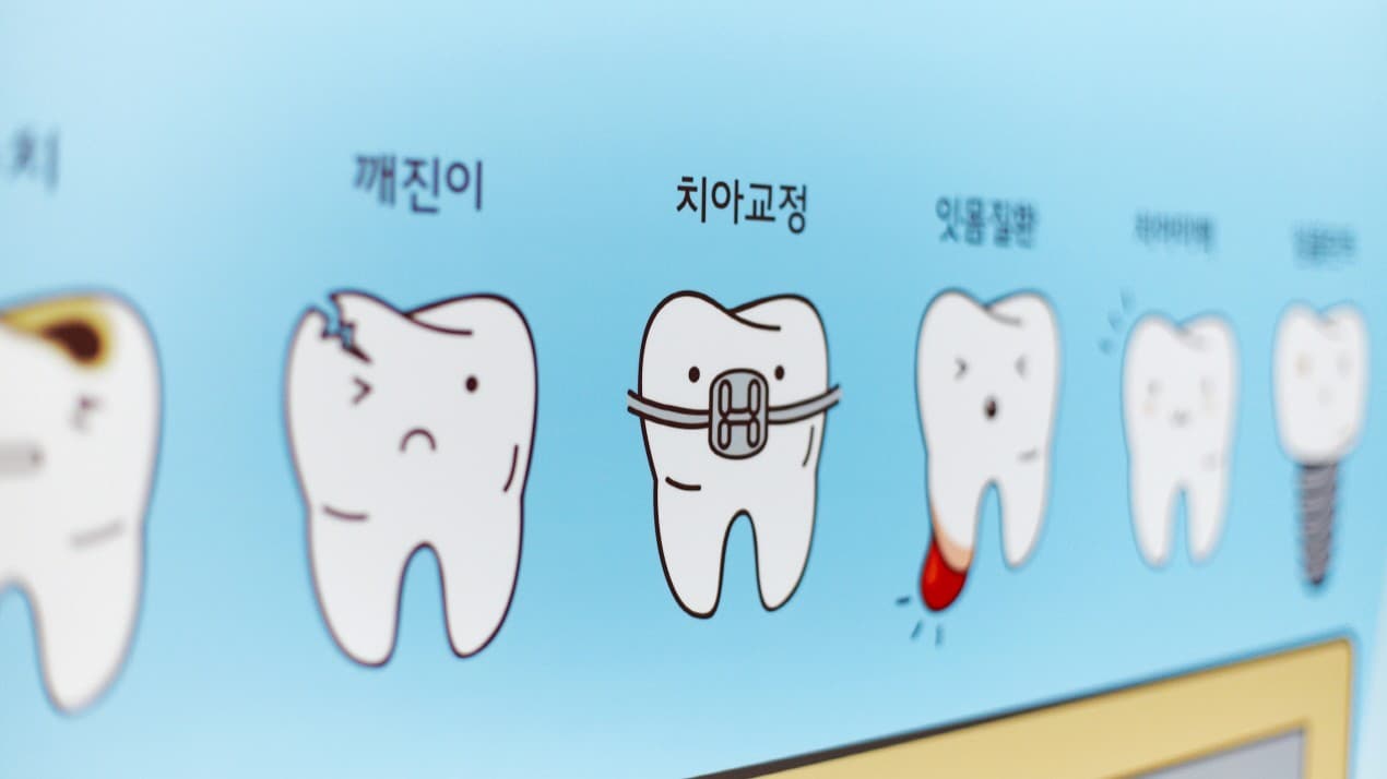 배너 2